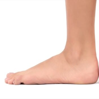 flat foot