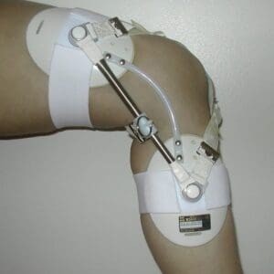 TVS KNEE BRACE